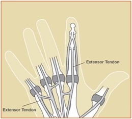 Image related to Extensor Tendon Injuries | Houston Tendon Treatment