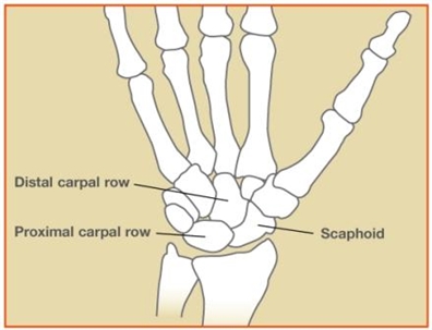 Image related to Scaphoid Fractures | Fractures and Sprains Houston TX