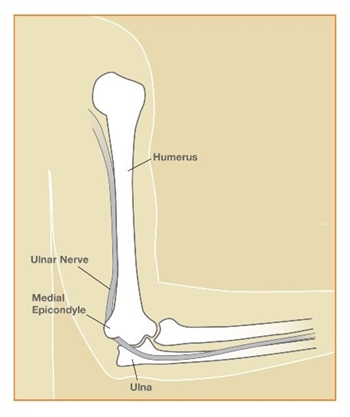 Image related to Cubital Tunnel Syndrome | Nerve Conditions, Houston